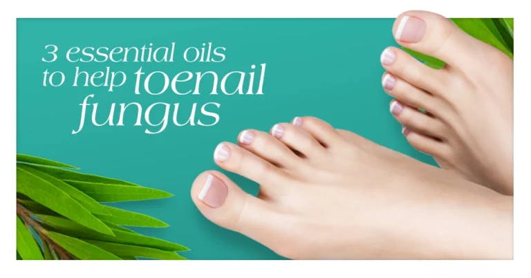 3 Essential Oils to Help Toenail Fungus