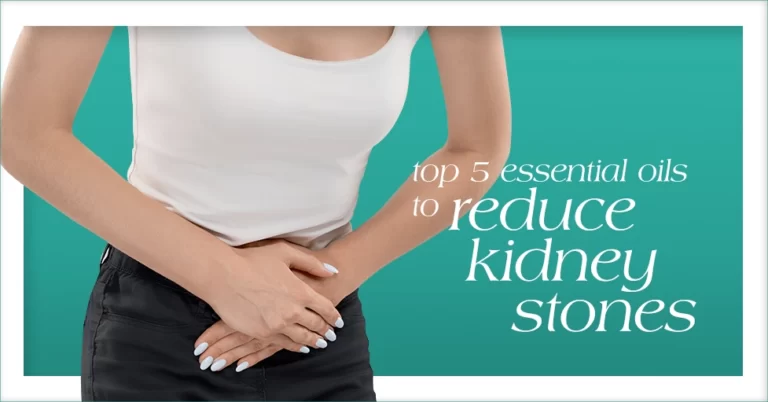 5 Essential Oils to Reduce Kidney Stones