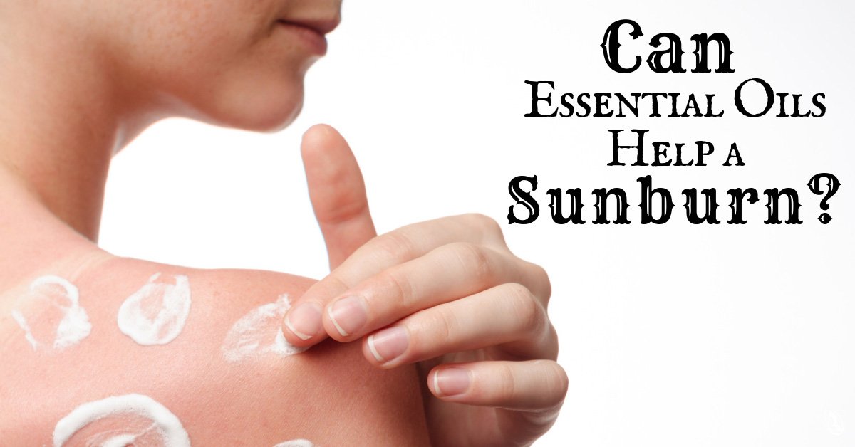 Can Essential Oils Help a Sunburn?