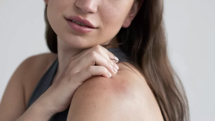 photo of a woman scratching her dry shoulder