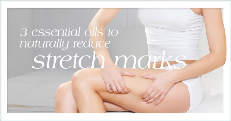 3 Essential Oils to Naturally Reduce Stretch Marks