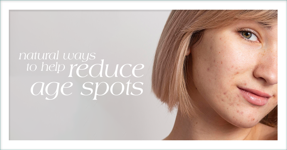Natural Ways to Help Reduce Age Spots Featured image