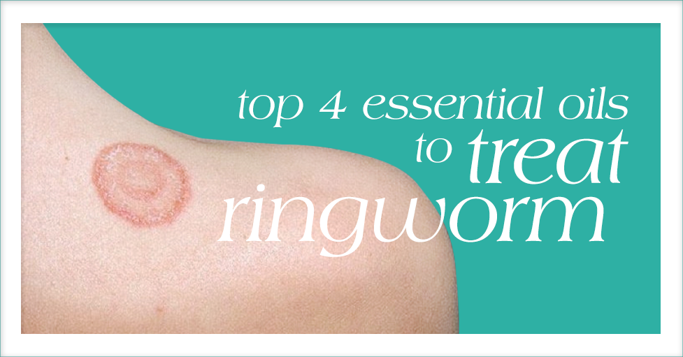 Ringworm Risk & Prevention | Ringworm | Types of Diseases | Fungal Diseases  | CDC