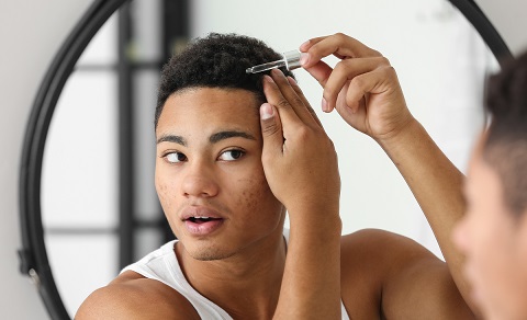 Young,African-american,Guy,Using,Serum,For,Hair,Growth,In,Bathroom