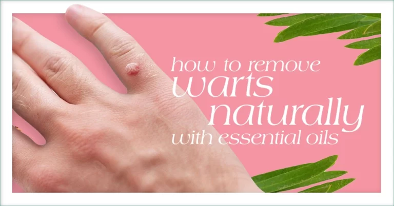 How to Remove Warts Naturally With Essential Oils Featured Image