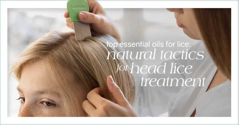 Top Essential Oils for Lice ; Natural Tactics for Head Lice Treatment Featured Image