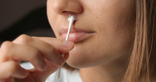 lady applying ointment to a cold sore