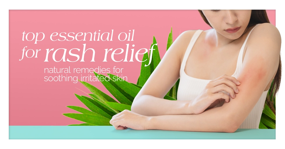Top Essential Oil for Rash Relief Natural Remedies for Soothing Irritated Skin featured image