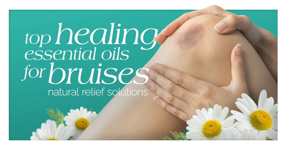 Top Healing Essential Oil for Bruises Natural Relief Solutions Featured Image