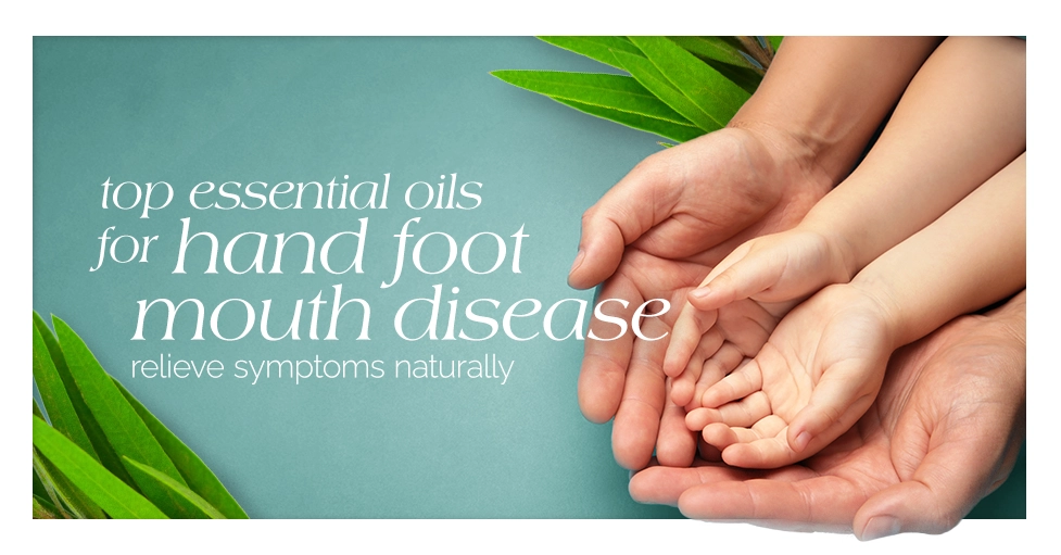 Top Essential Oils for Hand Foot Mouth Disease Relieve Symptoms Naturally Featured Image