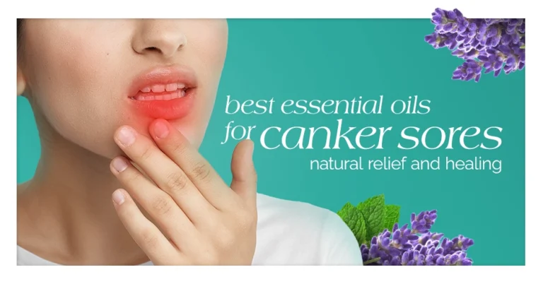 The-Best-Essential-Oil for Canker Sores Natural Relief and Healing Featured Image