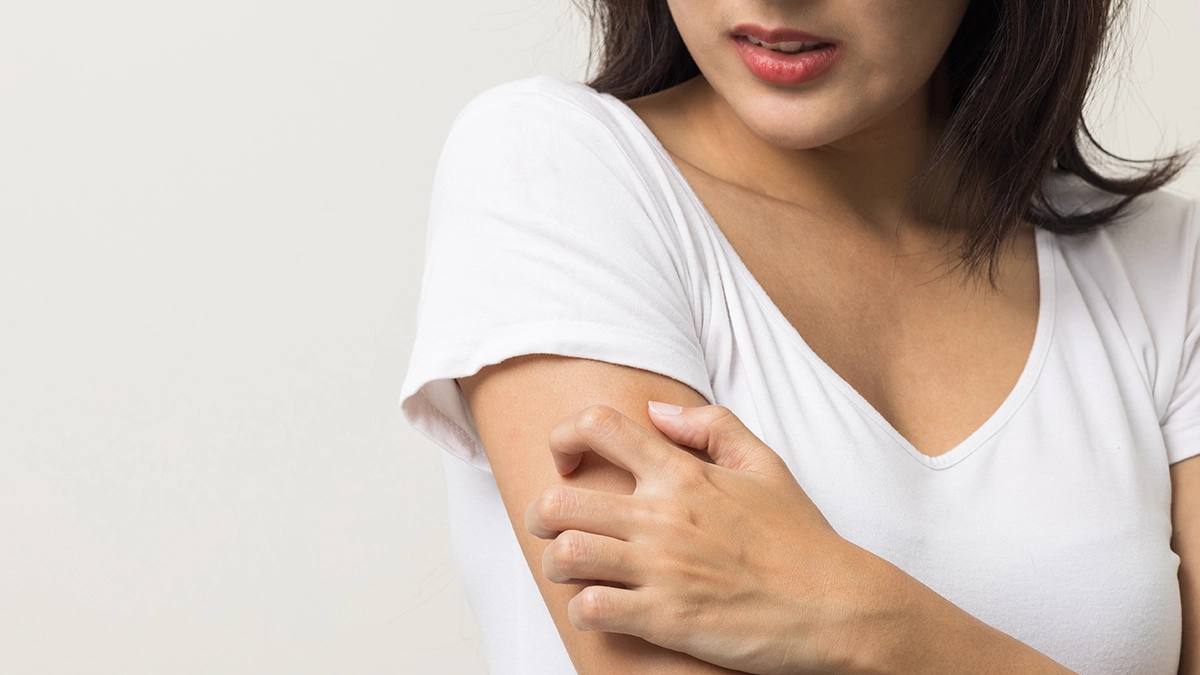 Woman scratching her arm, symbolizing lupus symptoms like skin irritation