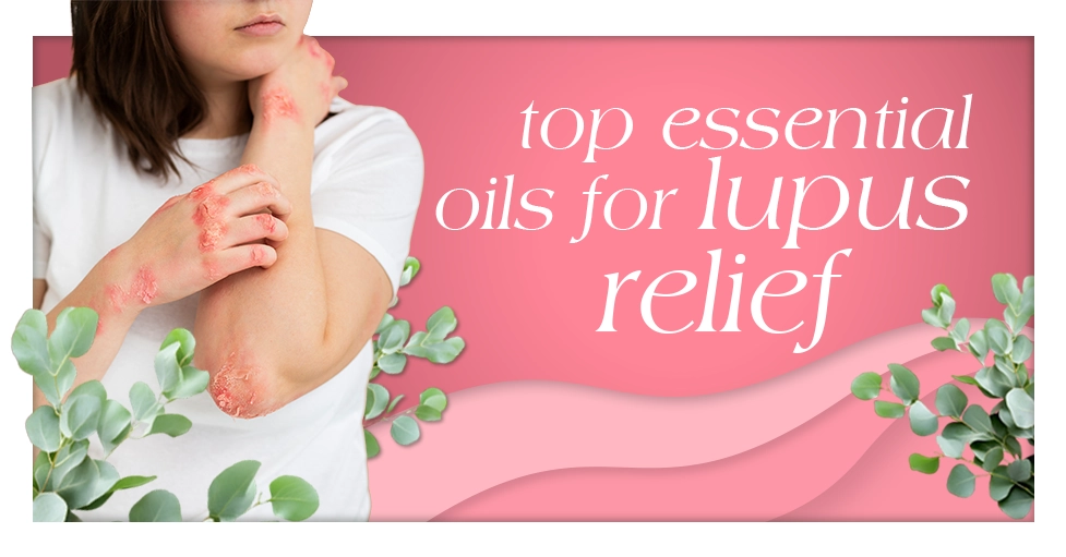 top essential oils for lupus relief Featured Image