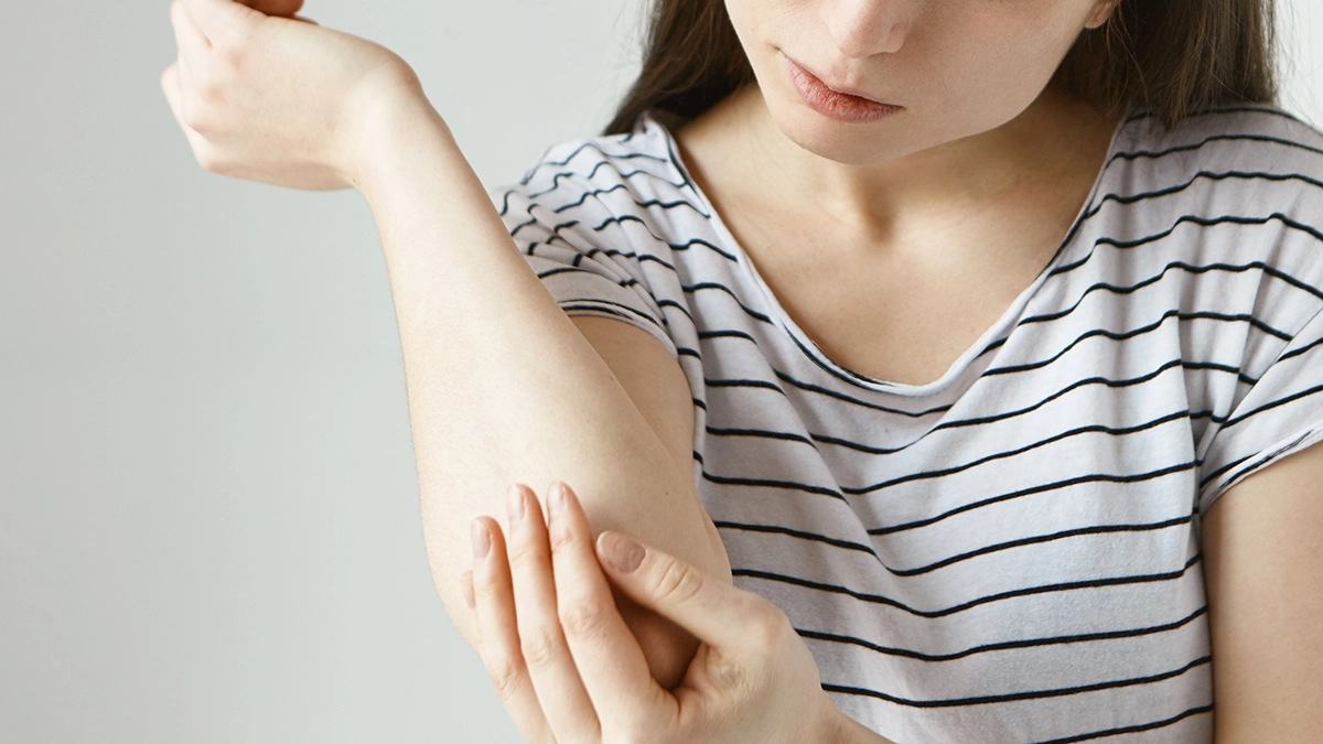 A young woman checks her elbow, concerned about a possible burn or skin injury, different types of burns and their treatment options