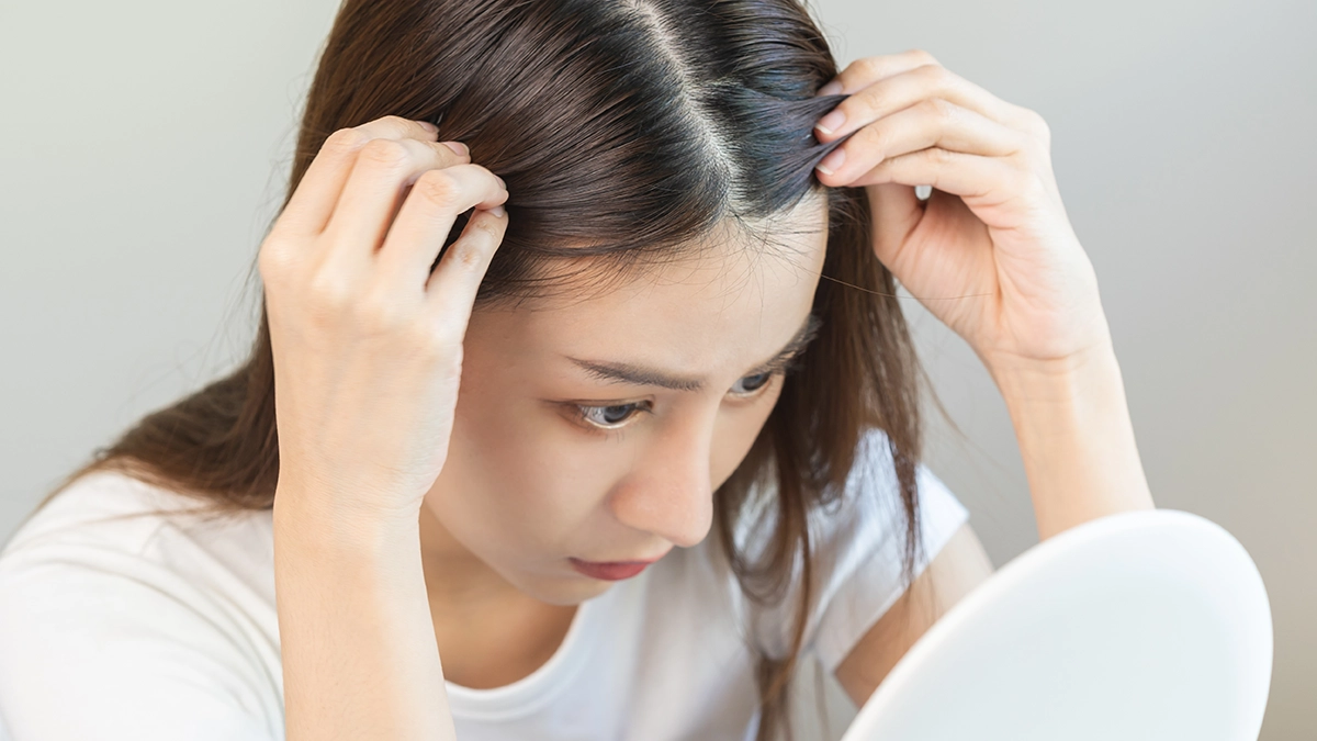 Person checking their scalp for pilar cysts, benign scalp growths