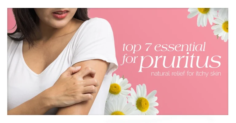 Top 7 Essential Oils for Pruritus Natural Relief for Itchy Skin Featured Image