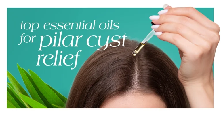 Top Essential Oils for Pilar Cyst Relief Featured Image