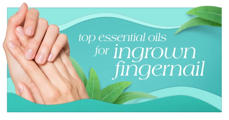 Top Essential Oil for Ingrown Fingernail Simple Remedies & Natural Relief Featured Image