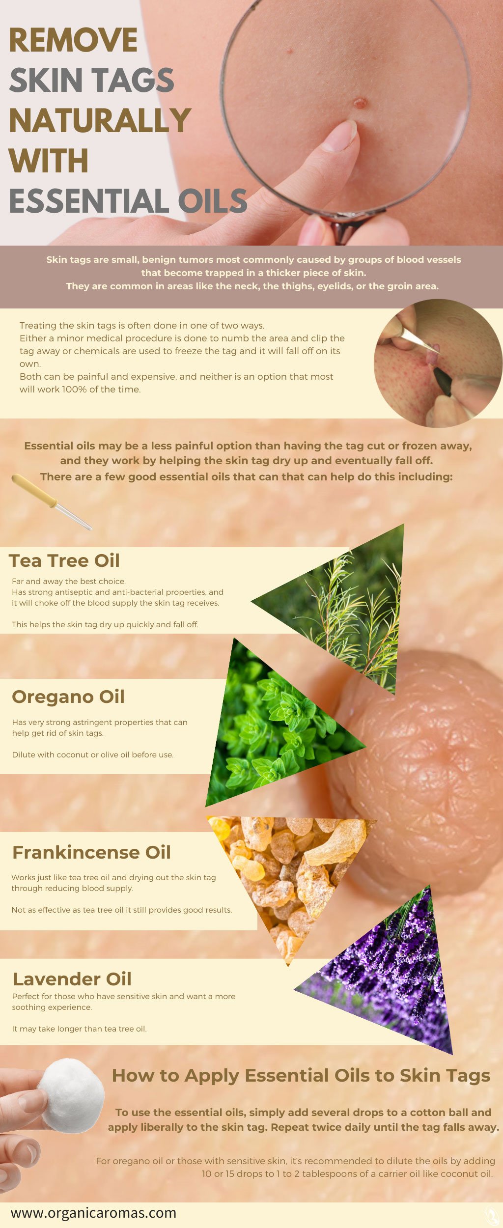 Essential Oils for Skin Tags 